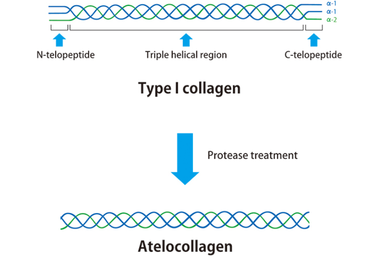  Atelocollagen 